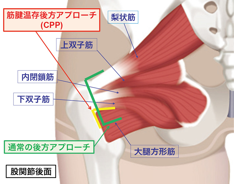 人工股関節について診療科・部門済生会横浜市南部病院