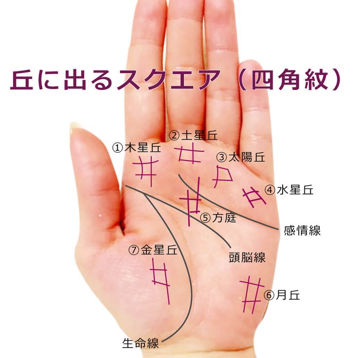 手相占い 四角紋による一発逆転度MIRRORZ ミラーズ無料の心理テスト・診断・占い