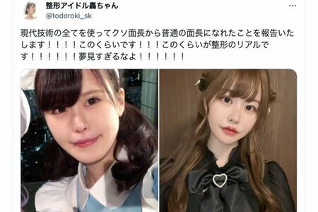 整形美女 「その顔で？」「ブス！」周囲の言葉に深く傷つき整形手術を繰り返した女性 、整形の先に見えたものとはオリコンニュース ORICONNEWS