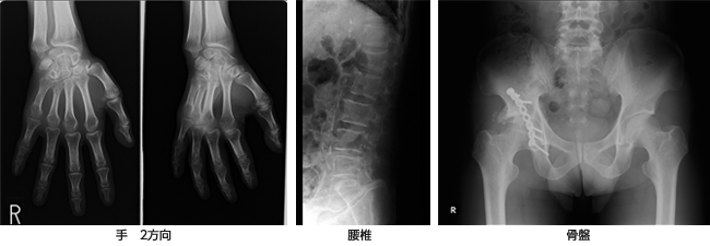 骨盤 仙腸関節 の治療診療メニューいでの整形外科リウマチ科クリニック