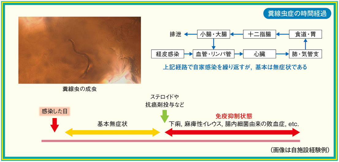 回虫症 Ascariasis– 感染症 - 神戸きしだクリニック 神戸市中央区