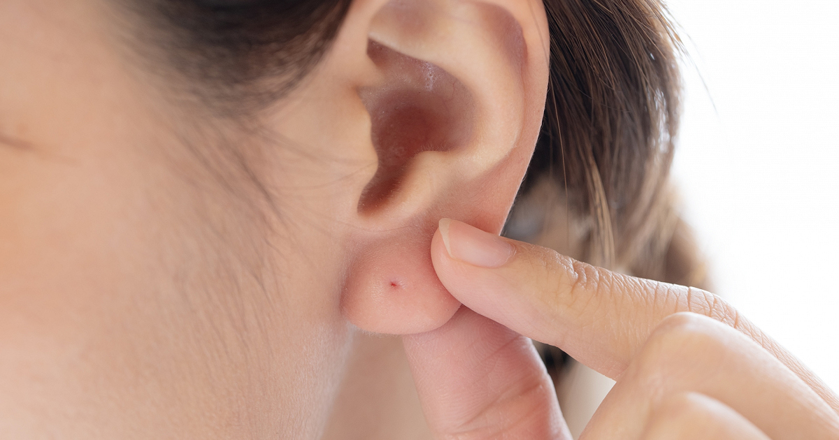 ファーストピアスの安定 つけっぱなしの最短期間はいつまで？ボディピアス凛軟骨ピアスまとめ