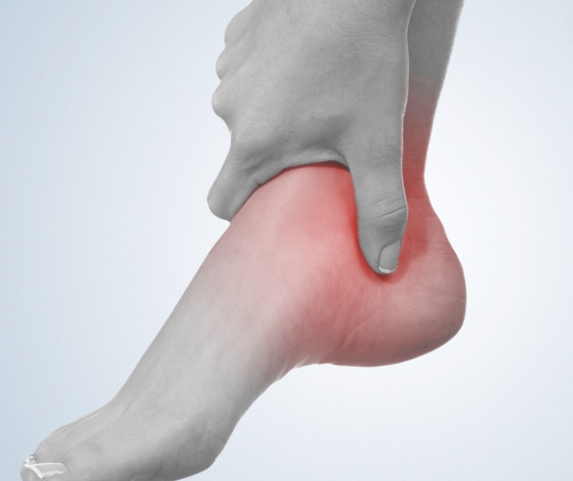 痛風を早く治すには？痛風の原因や治療・食事についてひまわり医院 内科・皮膚科