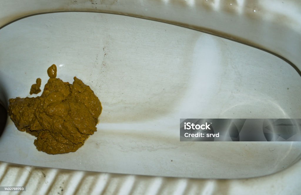 トイレ 便器 人間便器 - Pixabayの無料写真