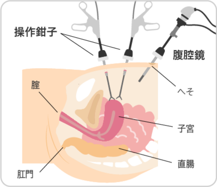臍下部 恥骨上部・下腹部正中 や下腹部全体の痛み症状から診療科を探す健診会 東京メディカルクリニック