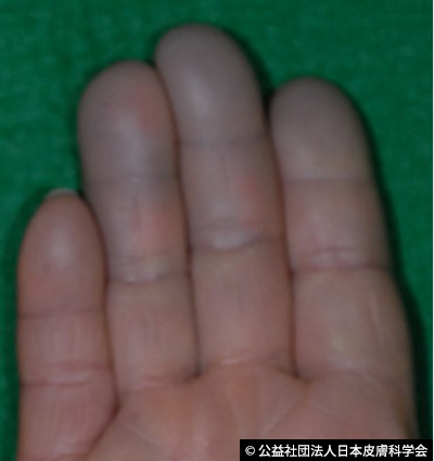 第二章 １．振動障害の原因および症状 一財 中小建設業特別教育協会