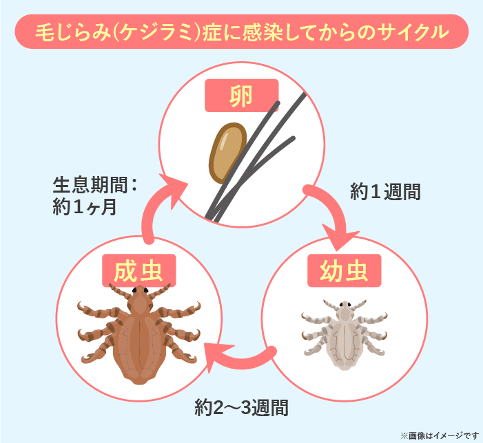 生態と種類を知るシラミウルトラ害虫 がいちゅう 大百科KINCHO