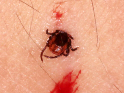 ブヨ ブユ ・アブの虫刺されに効く市販薬症状別の選び方や予防法を解説ミナカラ minacolor