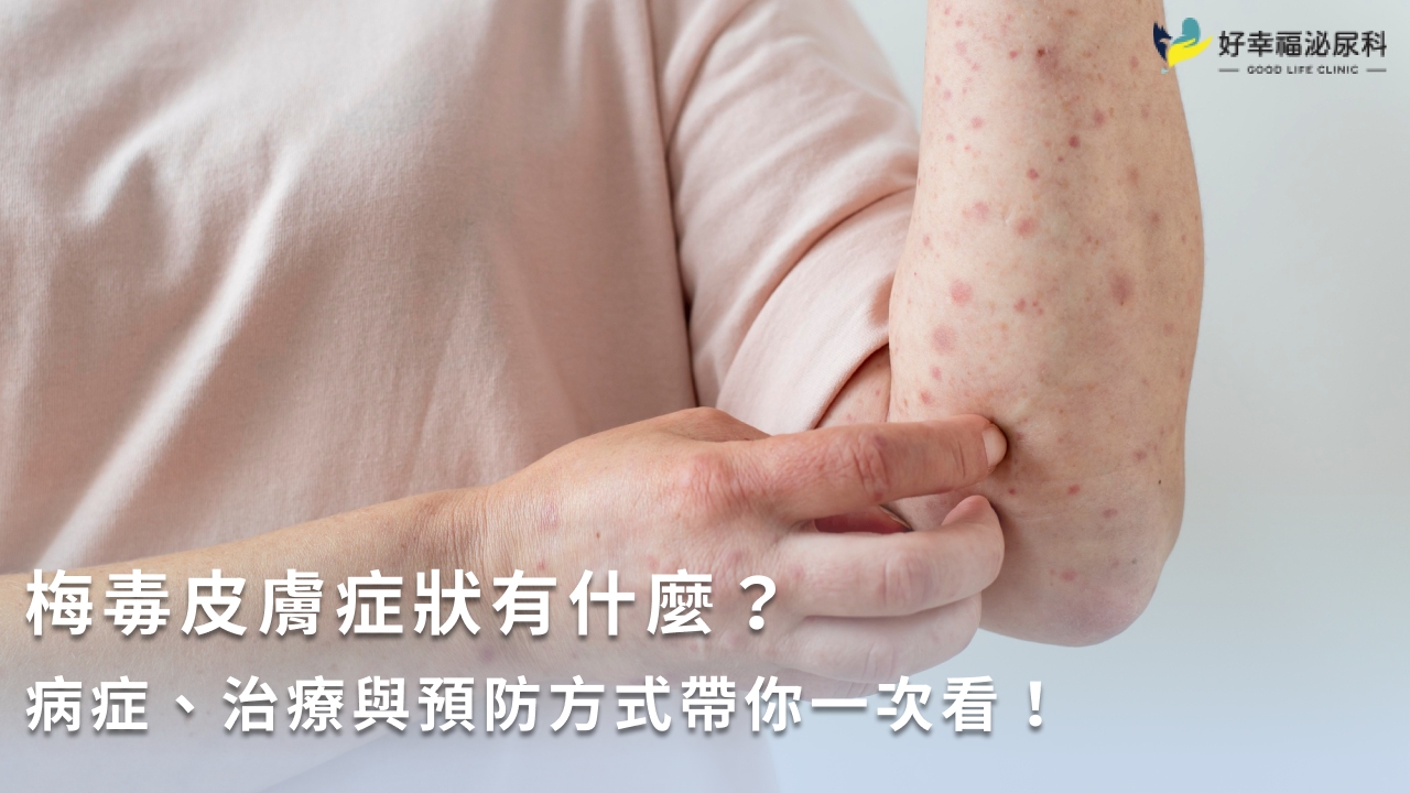 梅毒は治らない？先天性梅毒のリスクがある場合は早期に受診を！ - ルナレディースクリニックのメディア