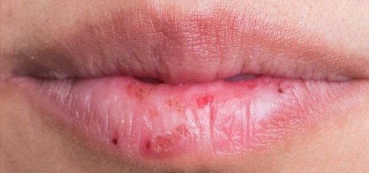 バズってた日焼け止めリップ全色正直レビュー‼️✨, 夏になると唇だけ日焼けしてカサカサになってたから、結構手放せなくなりそお、、🥺🎶,リップ資生堂コスメメイク