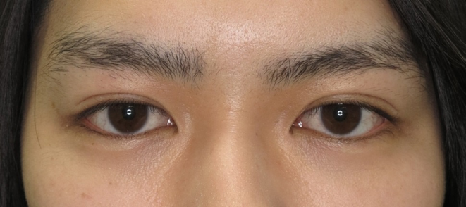 美容整形は常識？韓国女子の「整形事情」とは？ – K Village Meon 韓国スキンケア専門通販サイト