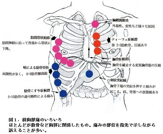 胃痛と胸から喉が苦しい喉の違和感 梅核気・ヒステリー球 、胃痛のツボツボネット 鍼灸の症例が検索できるツボ辞典