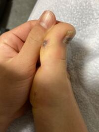 院長ブログ・整形外科コラムJR川西池田駅近の医療法人社団浜田整形外科