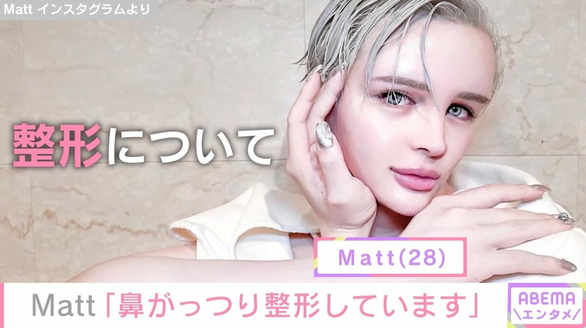 Matt マット桑田 が整形か画像比較注目は「おでこ」「目」「鼻」「顎」