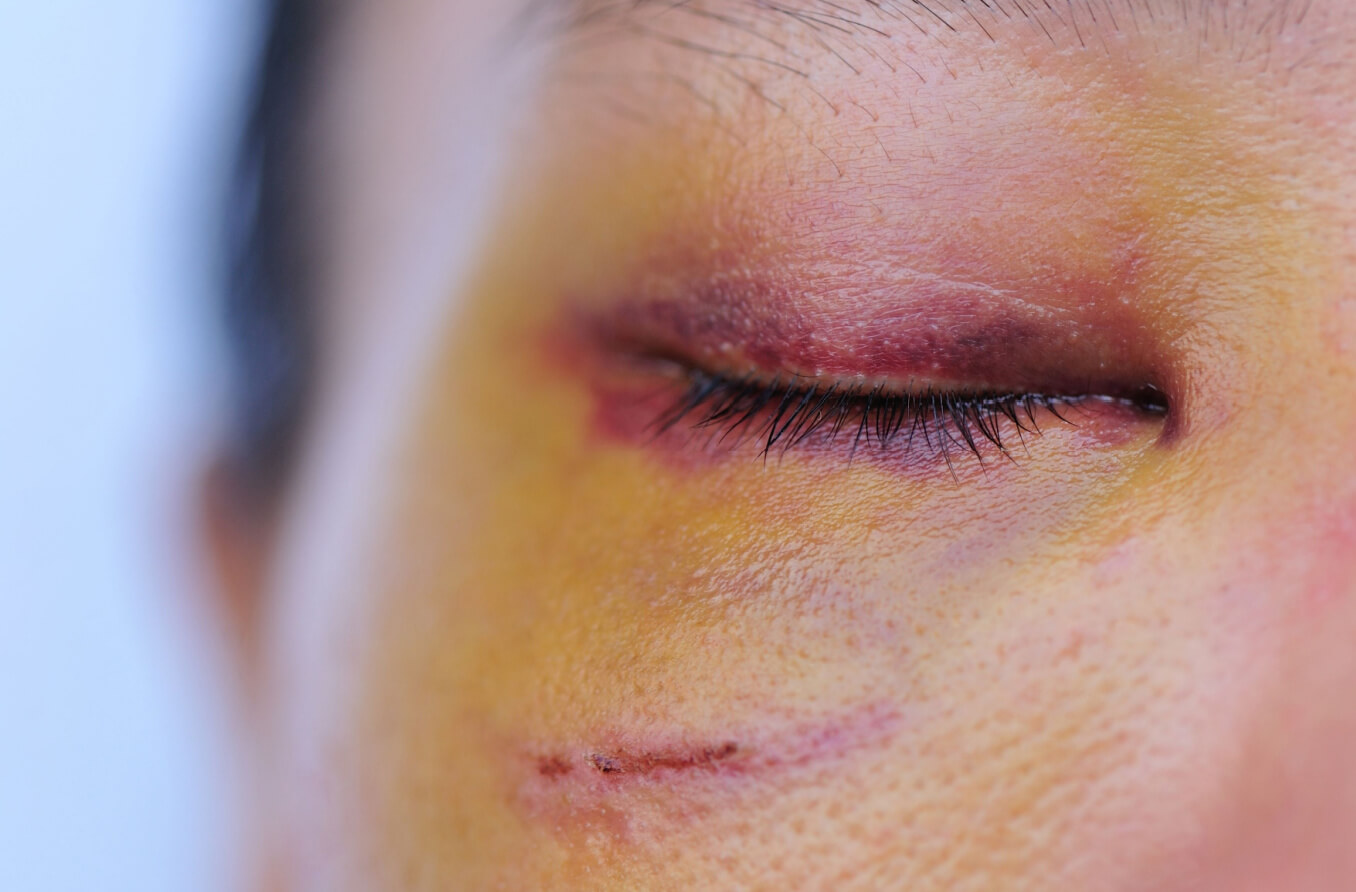 蚊を許そうと思う - ペットシッターSOS - 全国展開のペットシッターサービス