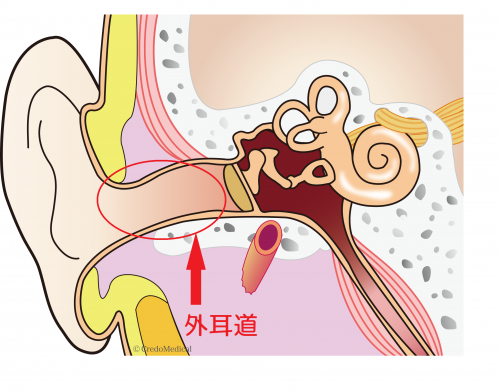 耳かき みみごこち 耳掃除 耳用 耳垢 乾燥 乾性 湿性 大人 子供 兼用 抗菌 日本製ポスト投函送料無料 : 健康fan日興メディカル - 通販 -Yahoo!ショッピング