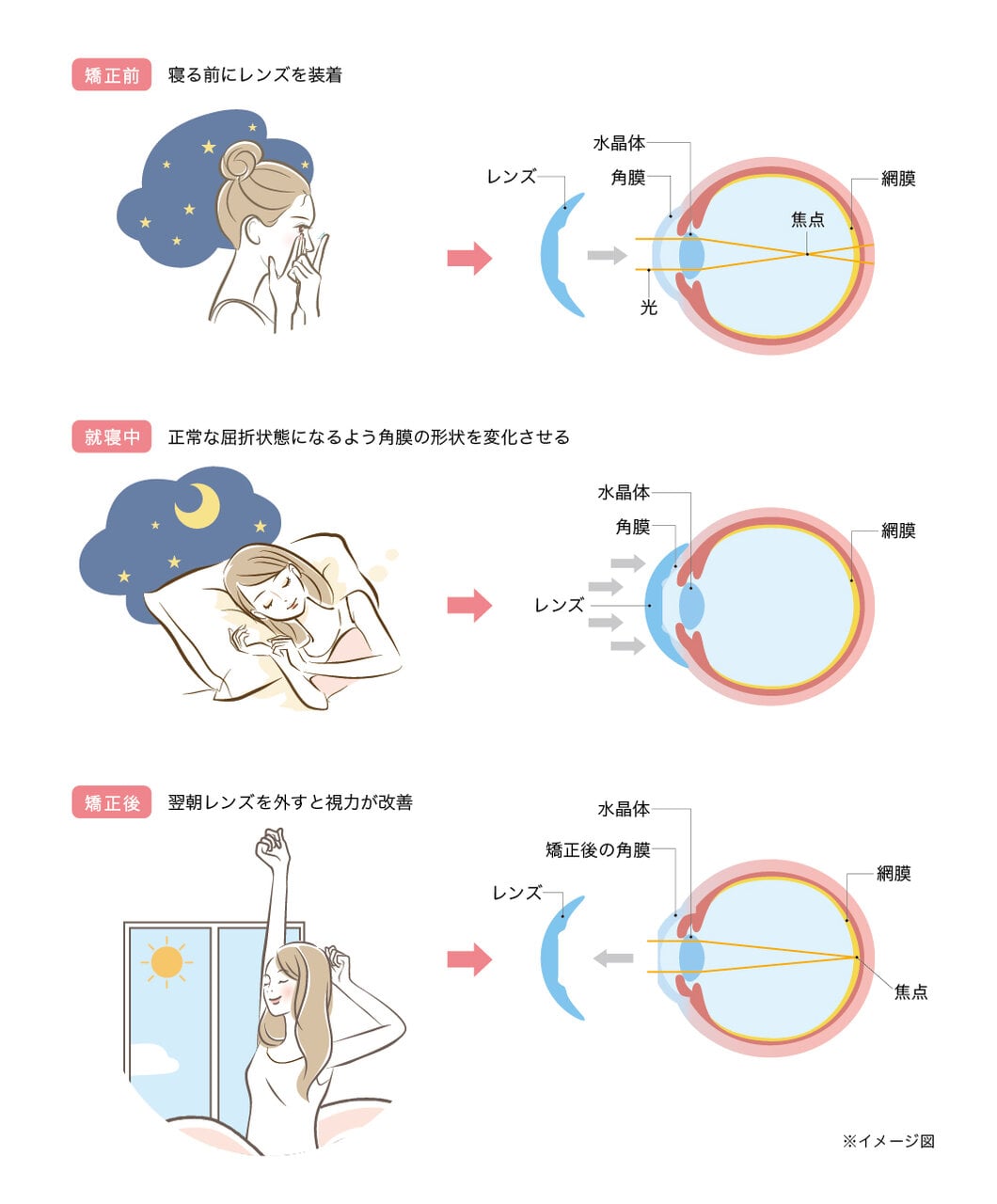 視力検査：病院で受ける検査事典：日経Gooday グッデイ