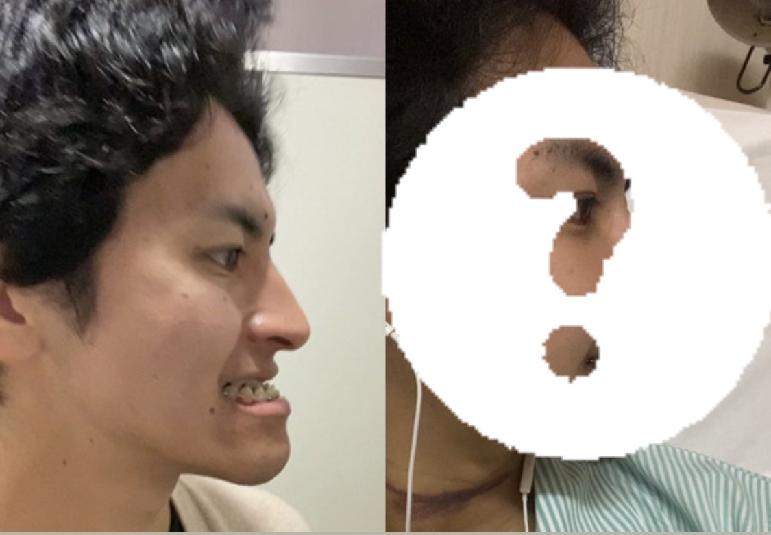 面長コンプレックスさん必見！生まれつき、ではありませんカラダの結果が顔骨に沼落ち中なんです