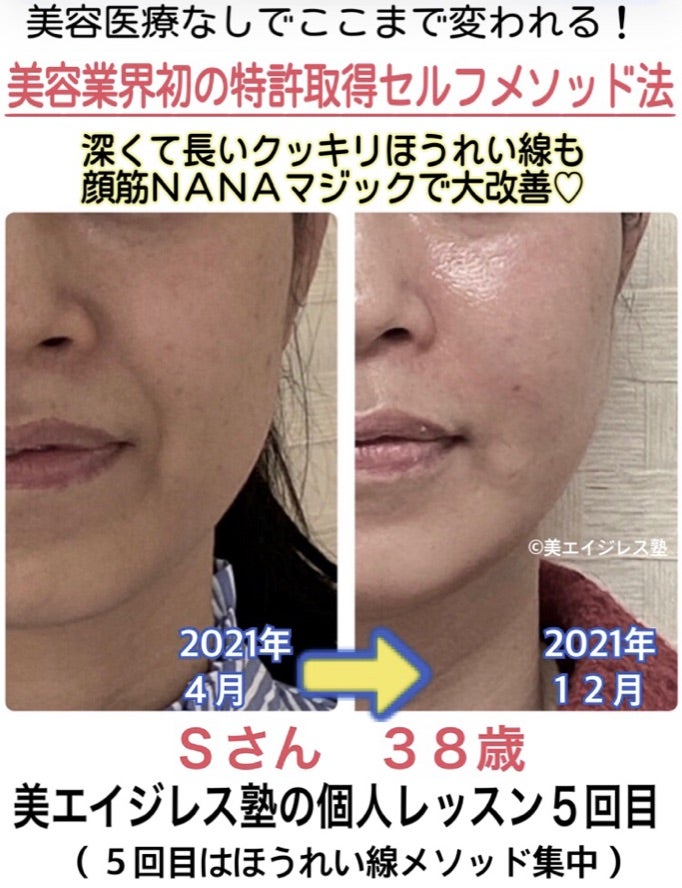 ほうれい線の消し方 ためしてガッテン流リンパマッサージ 〜4コマ解説〜キレイな女の教科書~BiBible