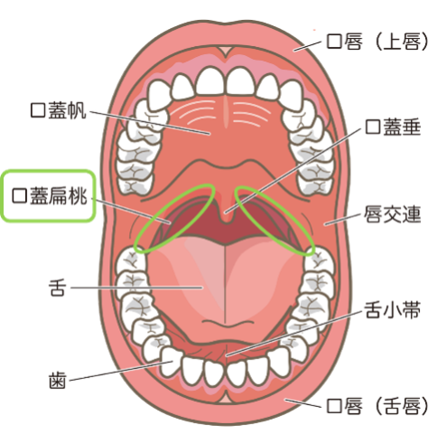 喘息治療に用いる去痰薬「ムコダイン」の特徴と効果、副作用横浜弘明寺呼吸器内科クリニック健康情報局