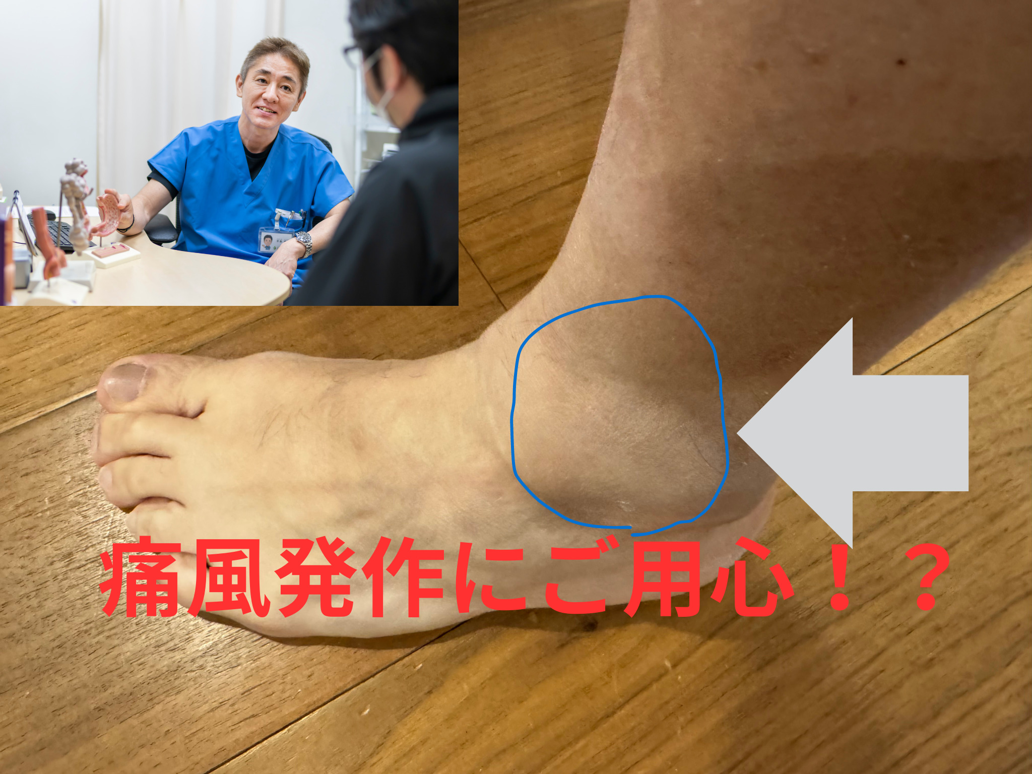 かかとが痛いのは痛風だから？予防のための食事について解説ボンラビ®：カラダの中から人生は変わる。30代・40代女性のためのメディア