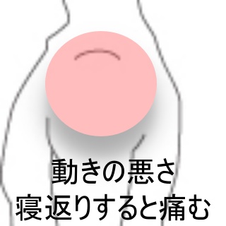肩を回すと引っかかるし痛い人必見！改善ストレッチ3選を紹介！医療法人社団 東整会 東京神田整形外科クリニック