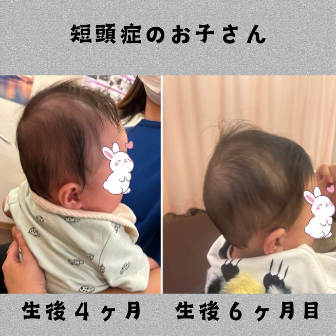 小頭症疑いだった娘の成長天地氣流気功「道」のブログ