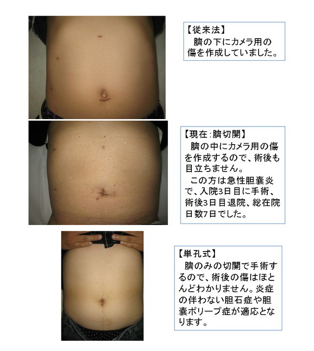 臍周囲の痛みと排尿時痛を主訴に受診した43歳男性キーフレーズで読み解く 外来診断学 133– 日本医事新報社