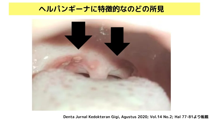 のどの病気 戸塚耳鼻咽喉科クリニック戸塚駅徒歩2分の耳鼻科