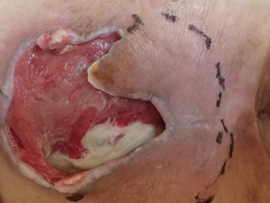 床ずれ・褥瘡を予防している看護師のイラストかわいいフリー素材集 いらすとや