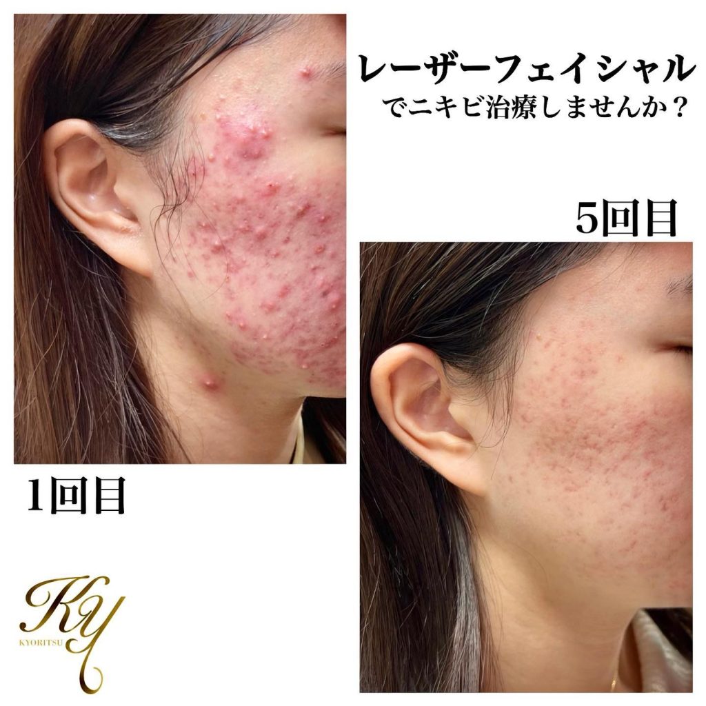 シミ貴クリニック