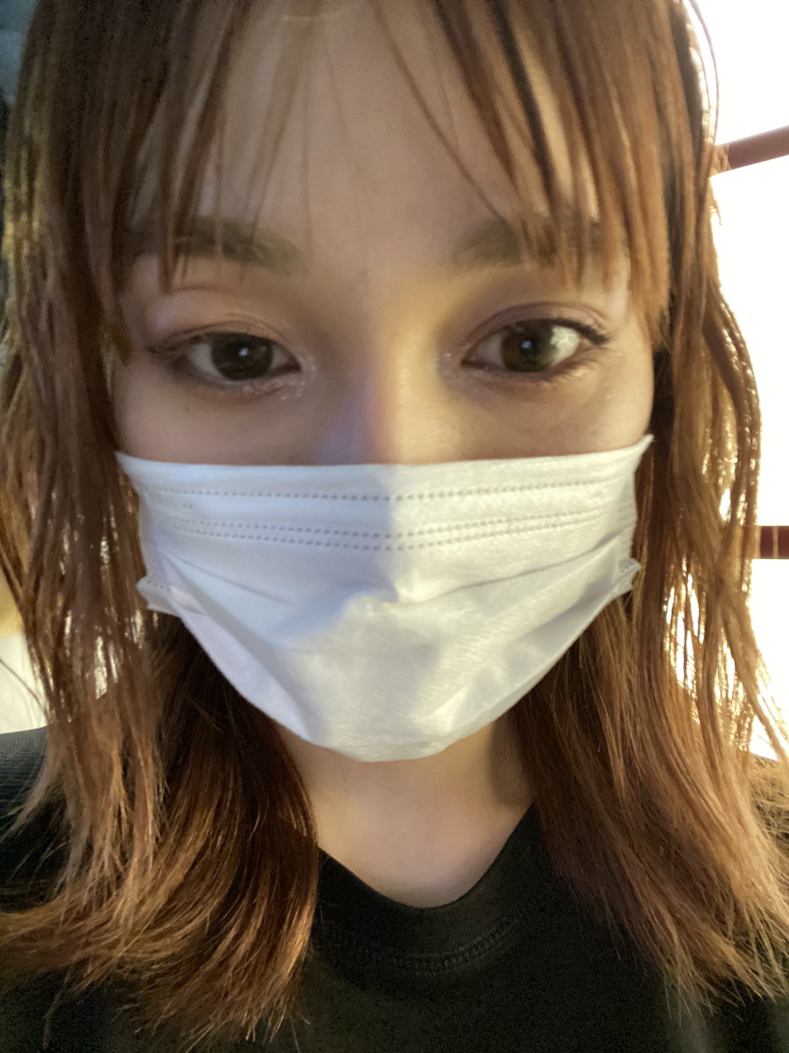 よくある目の症状 まぶたの腫れ・視界が白くぼやける・目がかゆい 中野区の新江古田いわた眼科