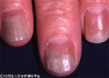 そういえばなんで爪の先は白いの？」「心と体の状態を反映するって本当？」 爪の専門家に聞いてみた - CanCam.jp キャンキャン