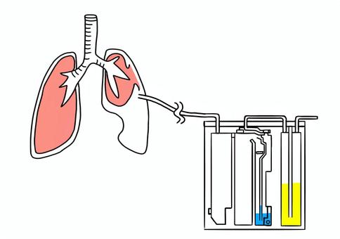 胸腔ドレーン挿入時の介助動画でわかる看護技術看護roo! カンゴルー