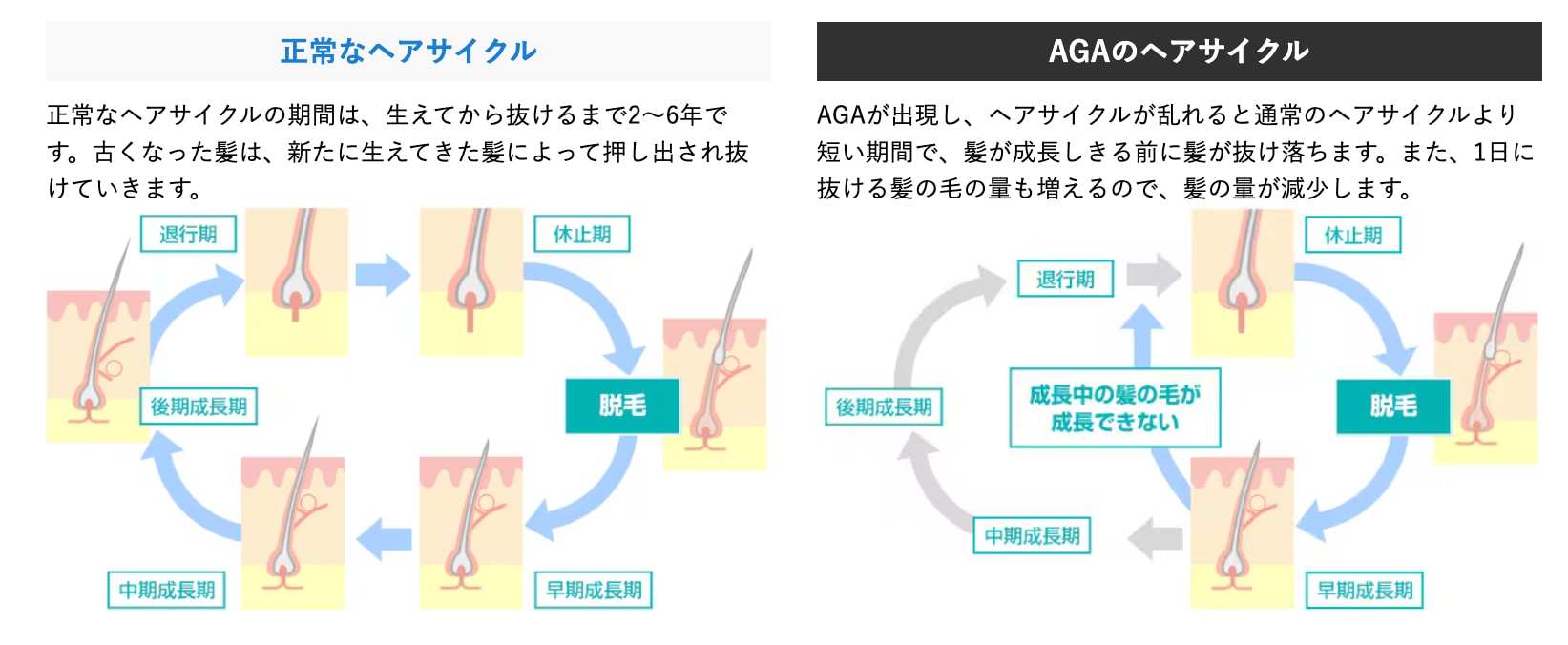 髪の毛の仕組みと成長抜け毛119番