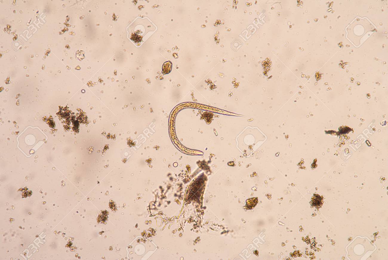 甦れ！食と健康と地球環境 第180回 見え始めてきた下肥の肥料化