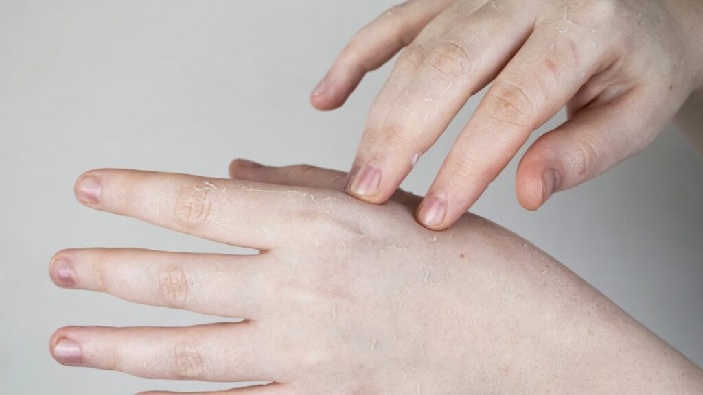 乾燥でお困りの指先におすすめ「パラフィンパック」tone village トーンビレッジ