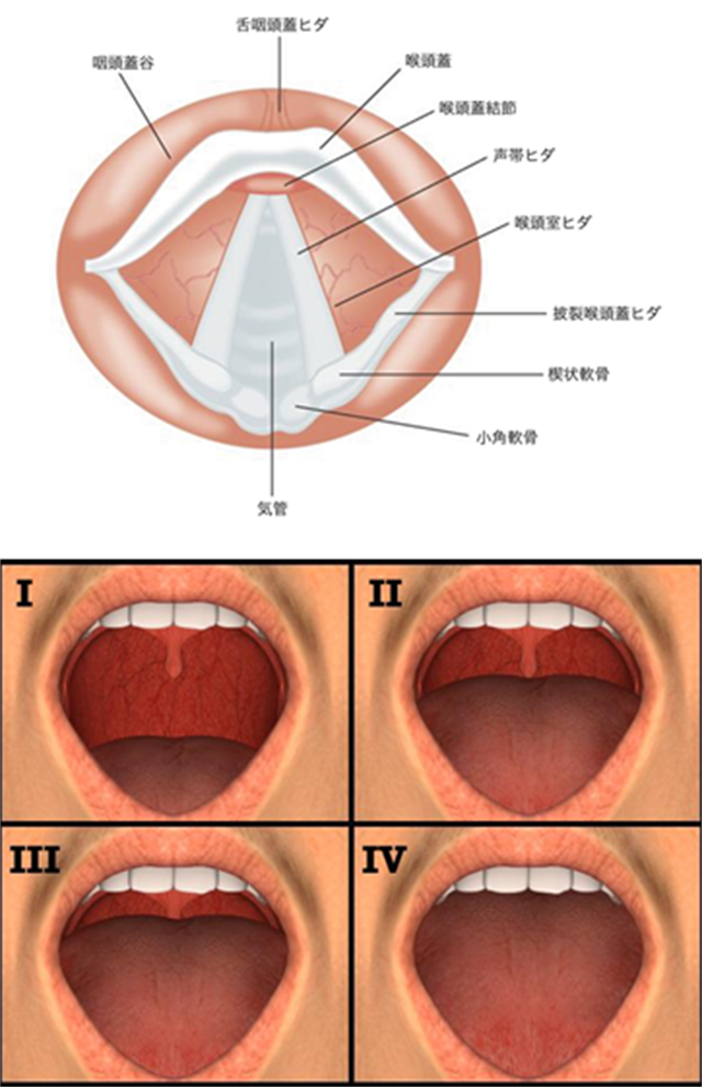 医師監修・作成 喉頭がんとはどんな病気?症状・原因・検査・治療などMEDLEY メドレー