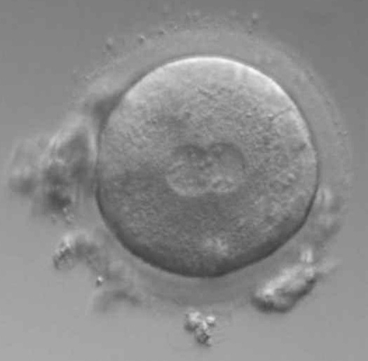 受精」のイラスト素材・ベクター画像 - イメージマートimagemart