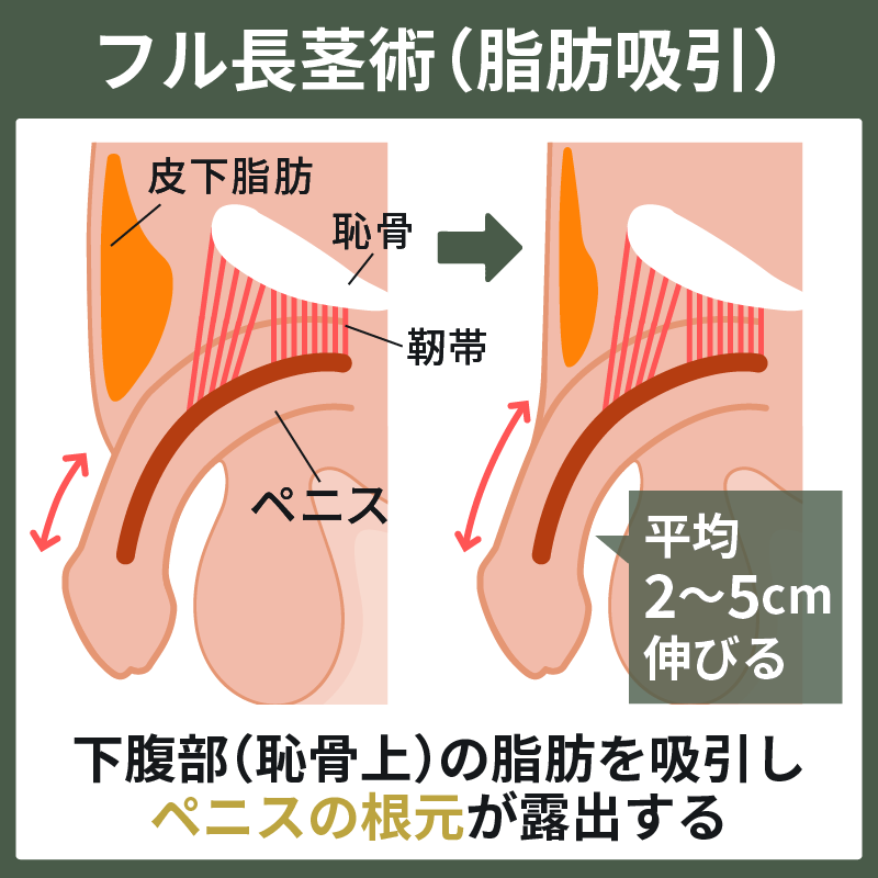 Amazon.co.jp: 電動オナホ 亀頭バイブ