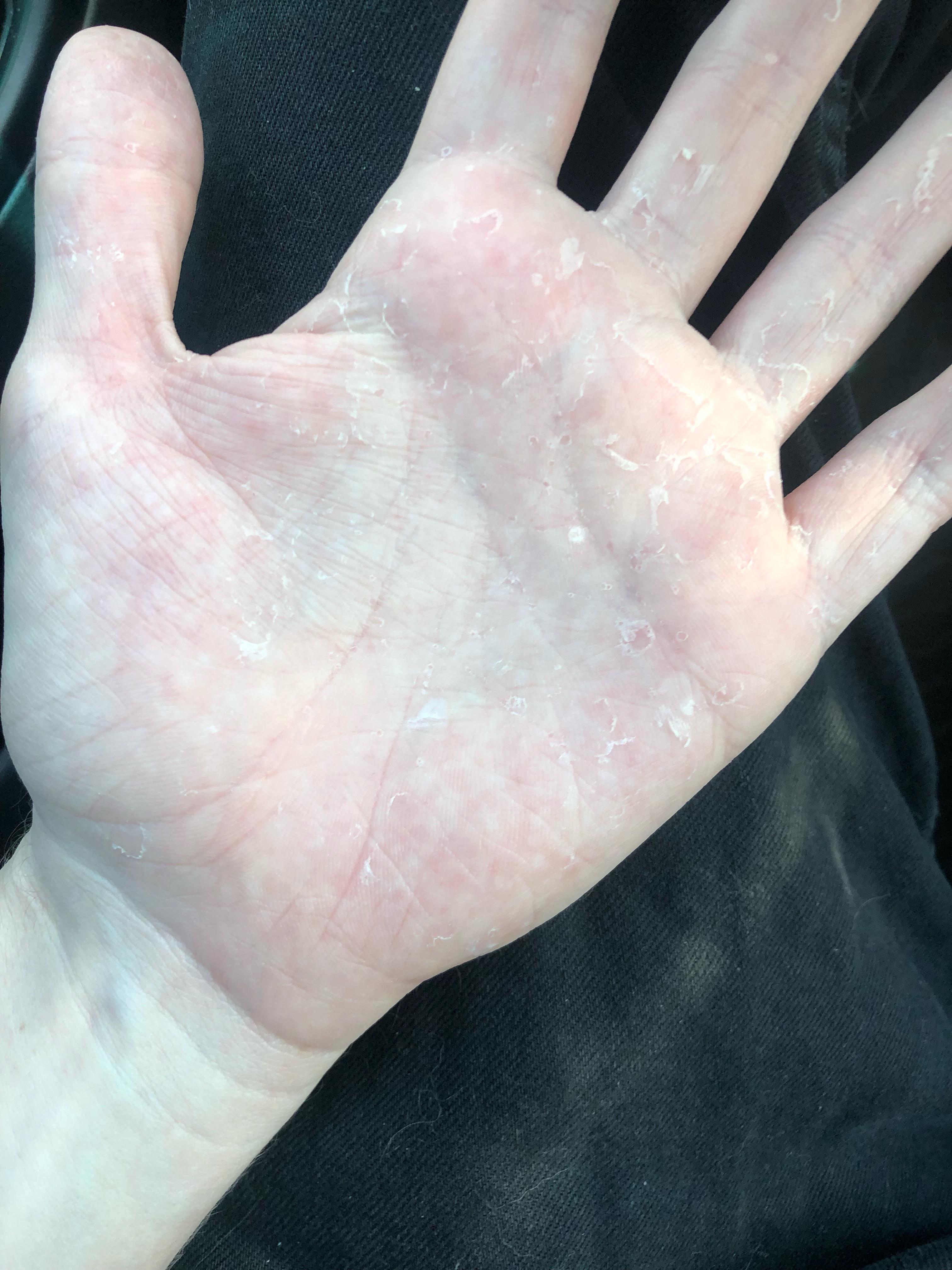 主婦湿疹中島医院 名古屋市千種区の内科、小児科糖尿病・甲状腺治療