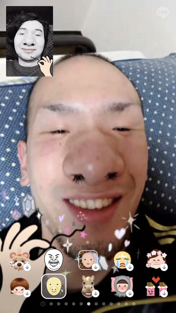 小鼻を自力で小さくする方法とは？医師が解説金沢の美容外科はeクリニック