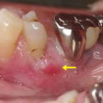 アセスE製品情報医薬品のアセス