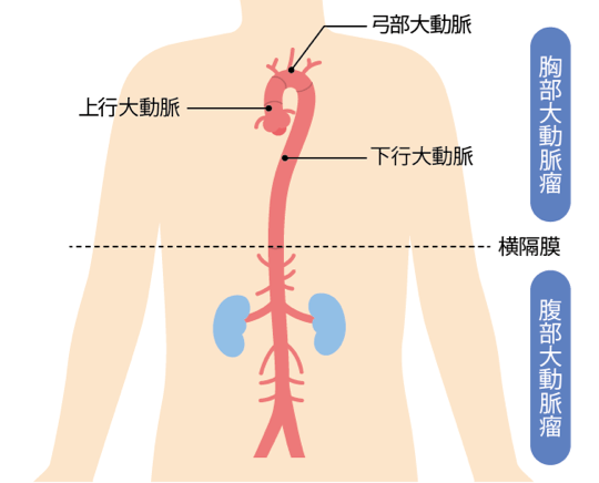 胸部大動脈」の画像素材 写真・イラスト- イメージマートimagemart