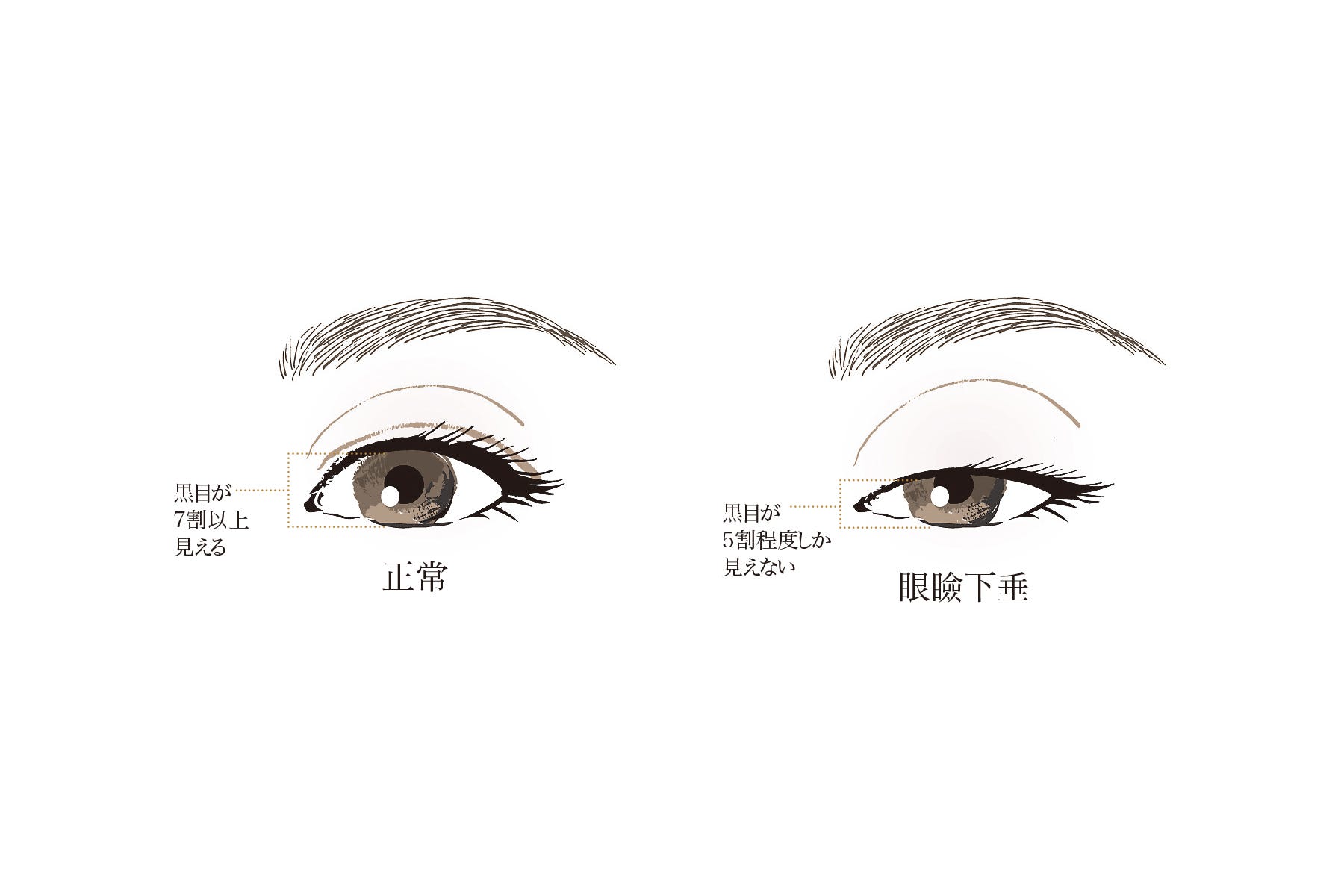 この頃、目が小さくなった？」年齢を重ねるとなぜ目が “小粒”に見えてしまうのかを解説！Precious.jp プレシャス