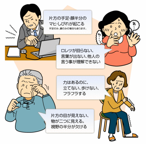 脳梗塞後遺症に有効なツボ 経穴 顔面、頭部編埼玉脳梗塞リハビリ脳梗塞・脳出血の後遺症改善