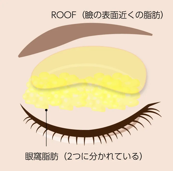 まぶた痩せの方法は?痩せたら二重になるのかなどの疑問を解説!公式 ASTRA BEAUTYCLINIC アストラビューティクリニック 美容外科・美容皮膚科・形成外科渋谷駅前