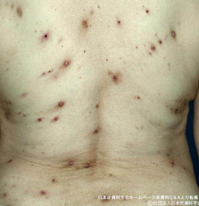 白玉点滴は危険なのか？安全性について専門家が詳しく解説します│SELECT CLINIC TIPS