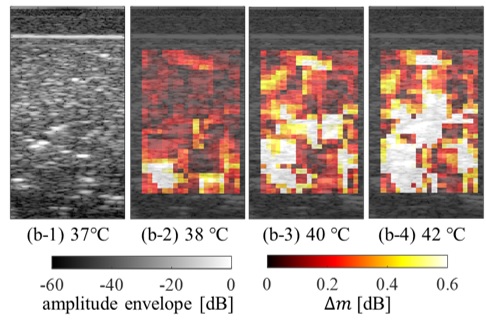 超音波検査 断層撮影法 - リィツメディカル