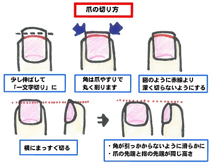 自宅でできる！ 自分でできる！ フットケア実践編コラム「足のちえぶくろ」ケアソク CARE:SOKU 株式会社山忠